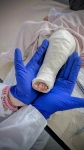 1. PEQUEÑOS YESOS, GRANDES BEBES