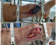 10. LA CIENCIA DE CUIDAR LO ROTO: HERIDAS QUE ENSEÑAN A CAMINAR DE NUEVO