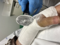6. BLANCO SOBRE TRAUMA